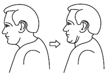 chin-tuck-exercise